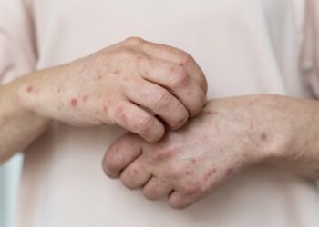 A HIQA report into care facility in Kilkenny raises concerns about disease mismanagement